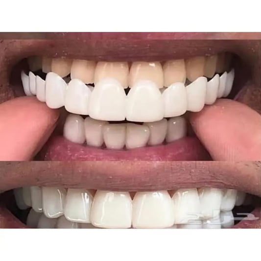 Facetas de Dientes Instantáneos - Click Buy Get you will like it